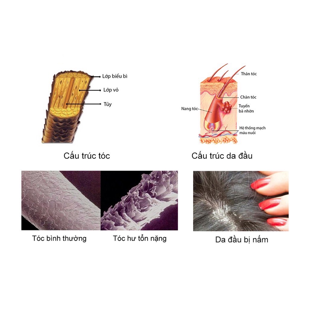 Bộ Dầu Gội LACO